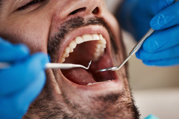 Best Emergency Dental Care  in Cleora, OK